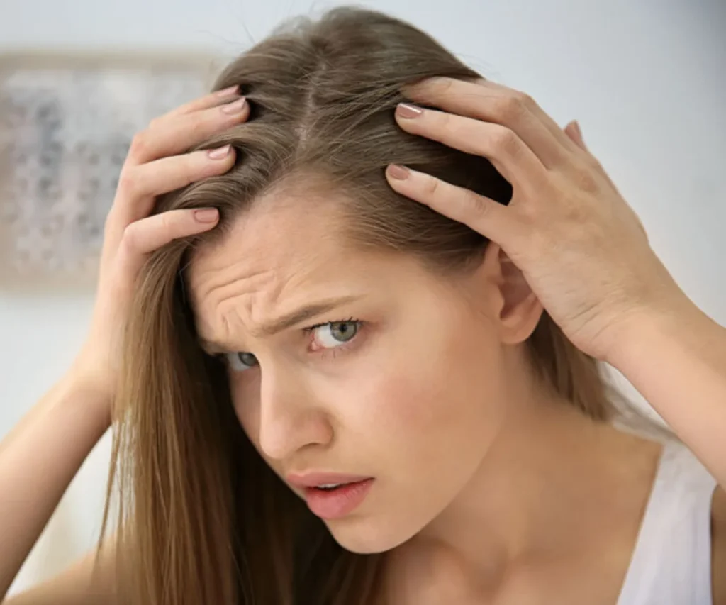 Hair Loss Homeopathic treatment